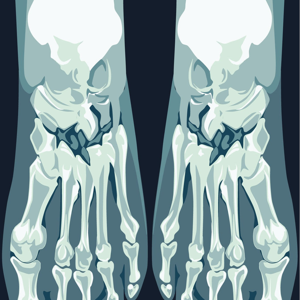 Skeletoes X-ray Crew Socks