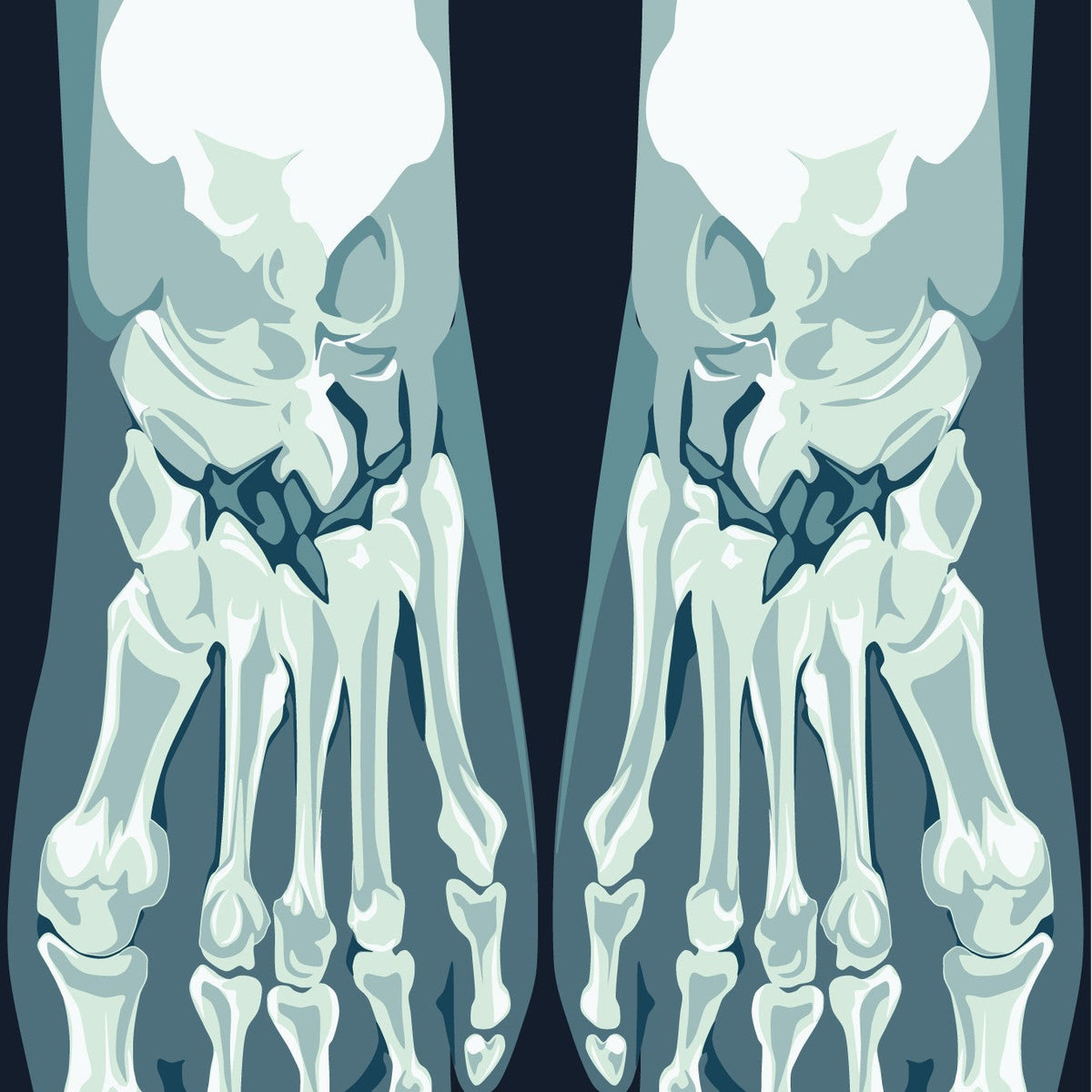 Skeletoes X-ray Crew Socks